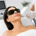 IPL o laser: quale tecnologia scegliere in istituto